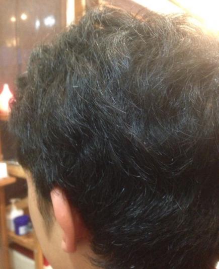 2013/11/14 07:04/斜め後方から施術前です。