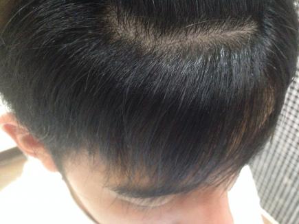 2015/07/29 07:02/仕上がりです(アフター)