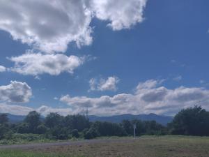 「☆顔のたるみの盲点…実は、鼻の下☆」の画像
