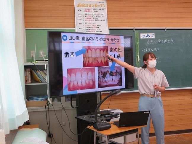 歯を大切に