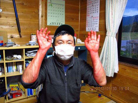 赤い手の人