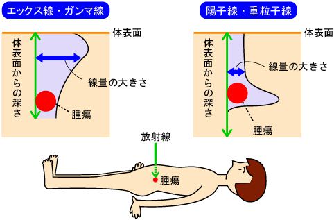 高度先進医療特約の必要性。