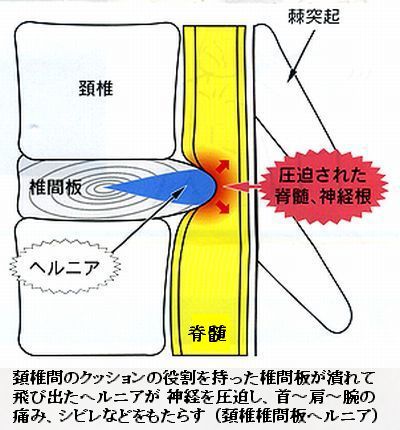 齢には勝てない！