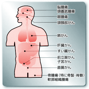 一歩前進