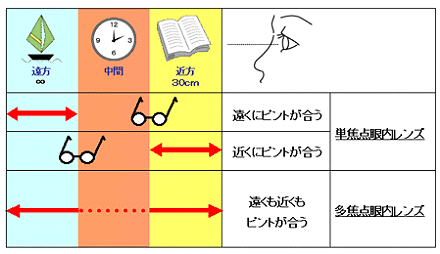 白内障
