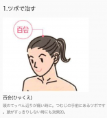 偏頭痛にかかって、、、