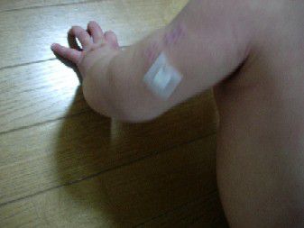 三種混合接種