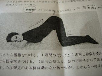 逆子　２