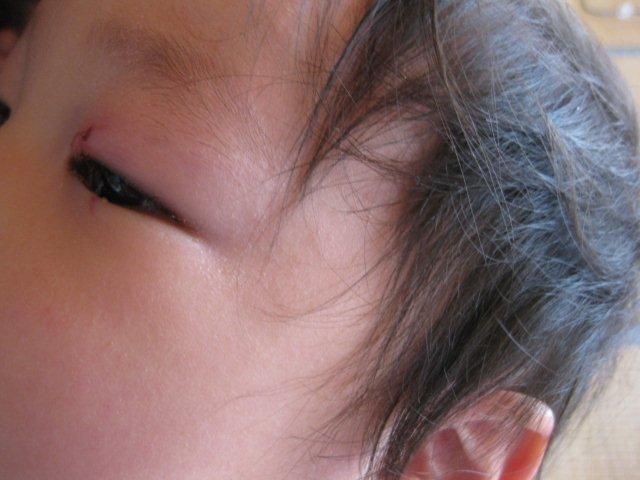 またまたボクサーに…