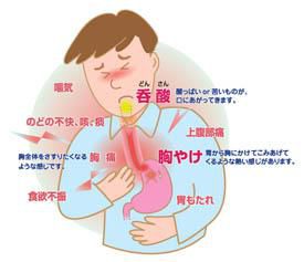 逆流性食道炎に背上げできるベットを。