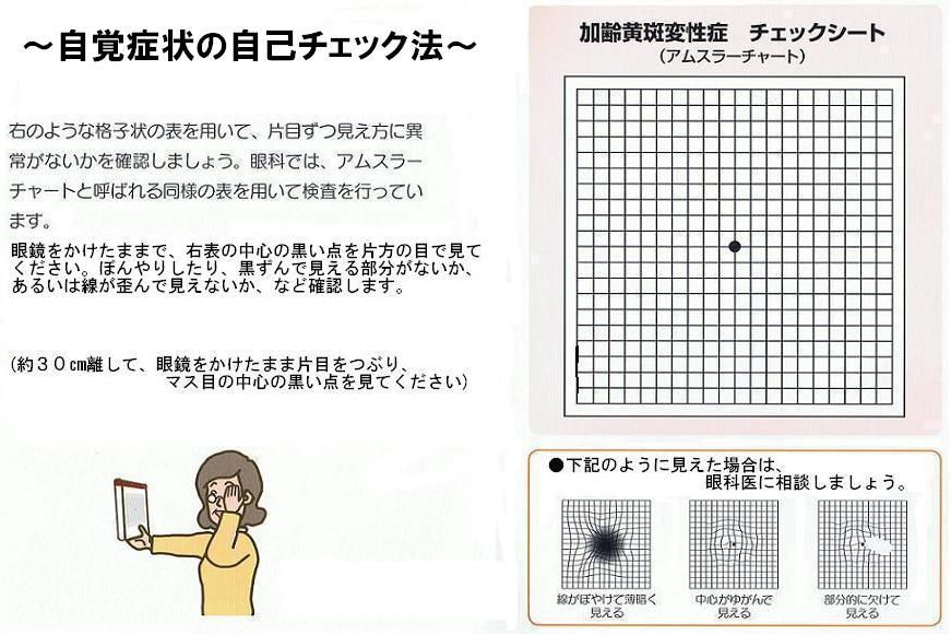 “耳より情報”②チェックシート