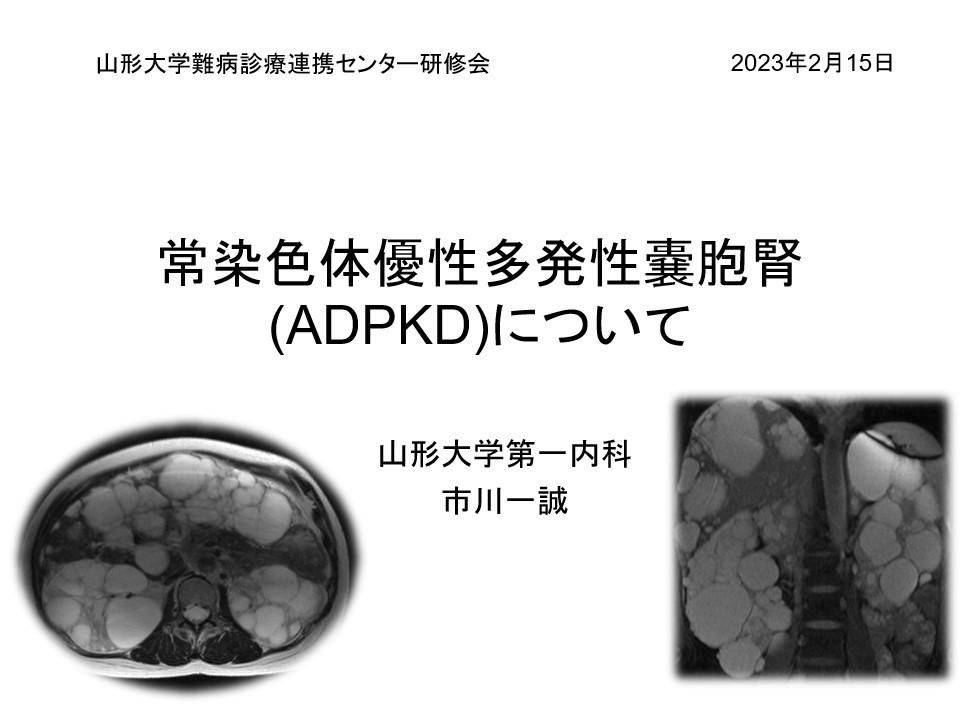 令和4年度第2回山形大学難病診療連携センター研修会の講演資料を掲載します。（講演資料その2）