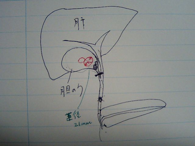 入院生活５日目（７月１１日／水）